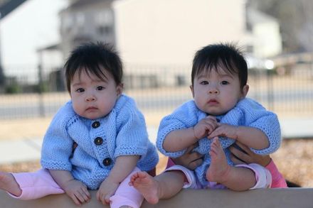 驚！1歲女嬰行動遲緩　檢查驚見「大腦裏藏着她的雙胞胎姊妹屍體」