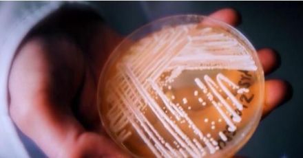 美紙廠爆致命芽生真菌疫情　罕見出現大型感染　症狀似肺炎、潛伏期21-90天不等