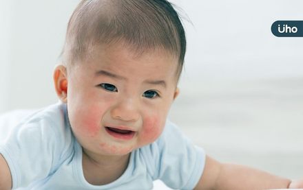 寶寶長痱子、尿布疹怎麼辦？醫：這一種會傳染