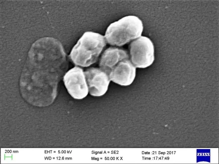 科學家利用AI發現全新抗生素　可殺死致命超級細菌