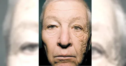 太陽很毒！69歲卡車司機「只有左臉曬太陽」臉竟只有半邊快速老化