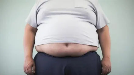 117公斤男少吃多動瘦不了　「內視鏡胃袖整形術」1個月減去12公斤