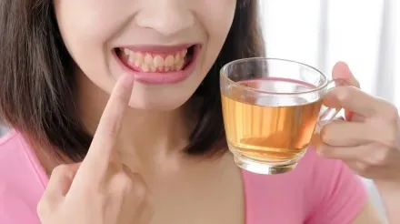 牙齒怎麼刷都黃黃的？常喝「這4種飲品」恐害牙齒炸黃　茶、咖啡都上榜