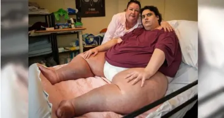 體重317公斤！英國最胖男生日前一周「器官衰竭」亡…享年33歲