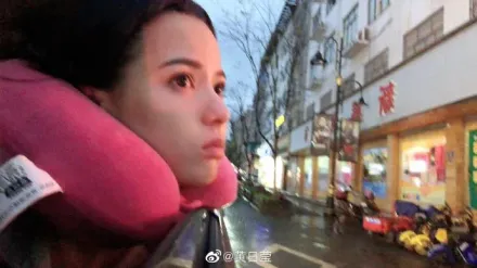 黃日瑩爆意外受傷「臉縫7針」！工作室曝最新情況引網不滿
