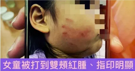 阿嬤跟妳拚了！桃園幼幼班女童午休發出聲響　教保員竟狂搧巴掌「留紅指印」