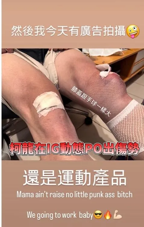 柯龍事後po出傷勢。（圖／翻攝柯龍的IG、《中天新聞》）