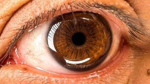 李典憲強調,慢性鼻竇炎最令人擔憂的是可能引起眼睛和腦部感染的併發症。(示意圖/Pixabay)