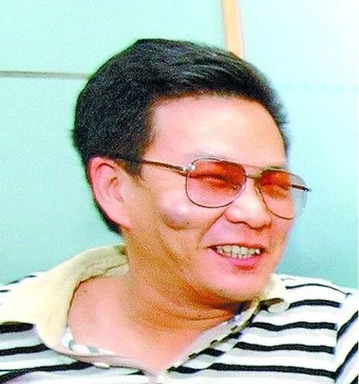 沈玉琳40歲那年切除面部粉瘤，命理專家推斷此舉有影響後來的血癌病況。（圖／資料照／中時新聞網）