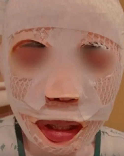 受害女子遭丈夫潑熱水毀容。(圖/翻攝FB@NNutt AAomsin)