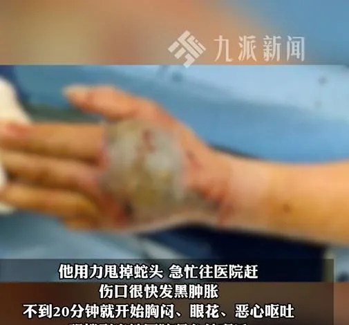老翁慘遭斷掉蛇頭咬傷。（圖／翻攝新浪微博）