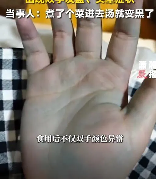 王女與家人食用「牛癟火鍋」後,竟雙手發藍。(圖/翻攝新浪微博)
