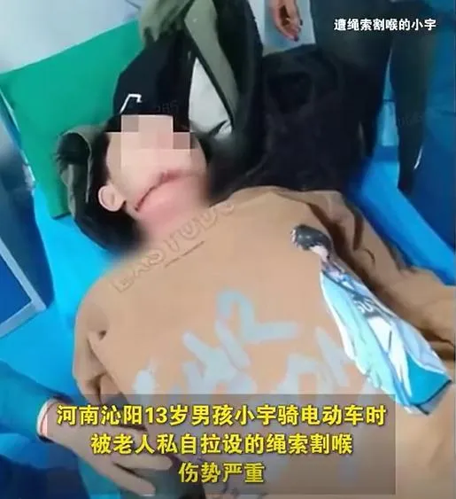小宇頸部有深深勒痕，觸目驚心。（圖／翻攝新浪微博）
