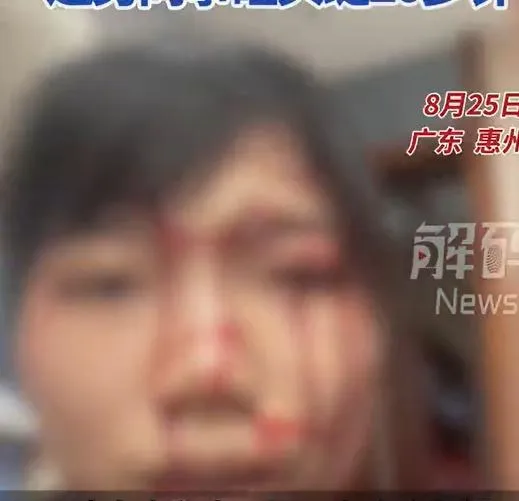 被砸的陳姓女子血流如注。（圖/翻攝新浪微博）