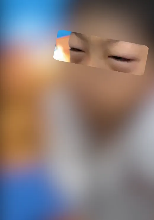 有學生因被罰倒立，因時間太常出現眼睛腫脹的情況。（圖／人本基金會提供）