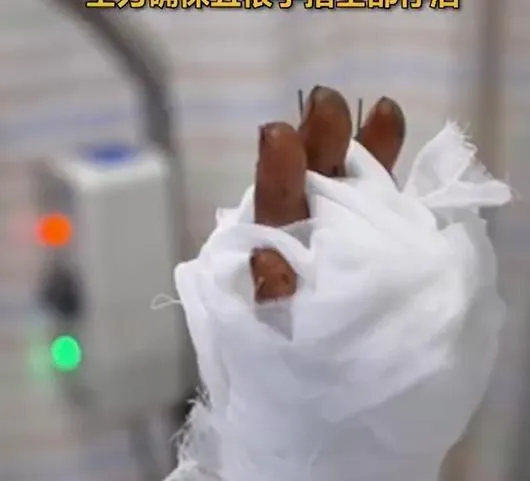 女子操作沖床左手不慎被壓中。(圖/翻攝新浪微博)