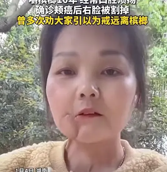 罹癌後她切除右臉保命。(圖/翻攝新浪微博)