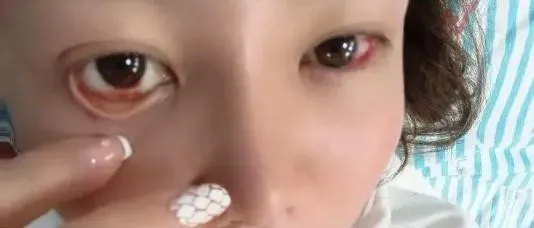 該女子觸電後,眼眶布滿血絲。(圖/翻攝自「華商報大風新聞」)