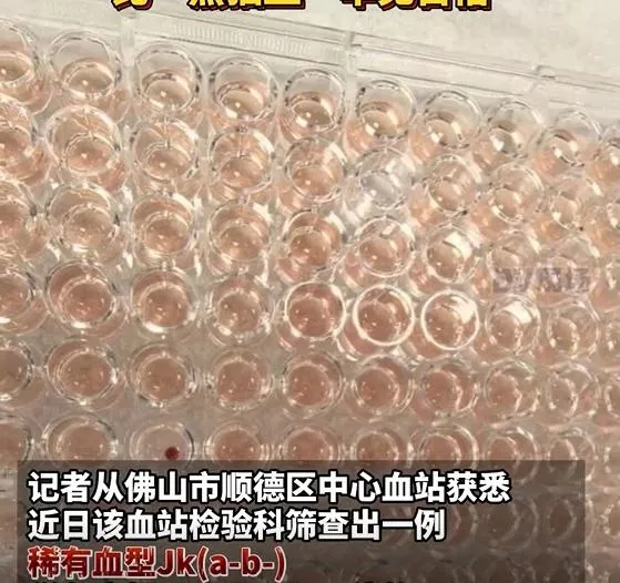 廣東省佛山市順德區發現罕見「鑽石血」。（圖/翻攝新浪微博）