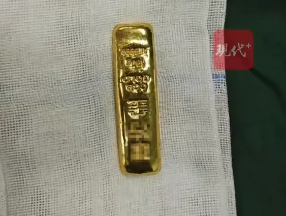 因男孩無法藉排便排出這塊重達100公克的金條，醫生進行手術干預，所幸男孩無恙。（圖／翻攝自微博@現代快報）