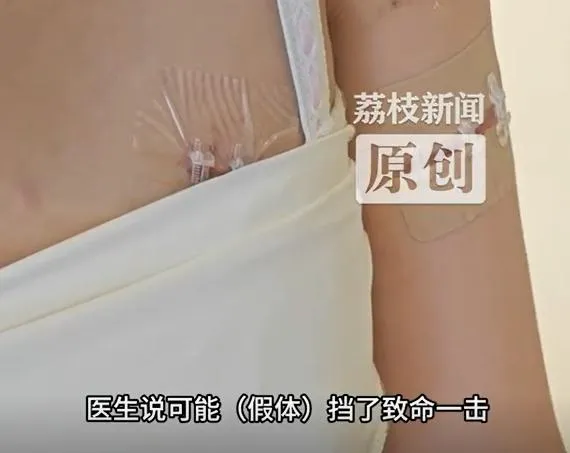 女子隆乳內的填充物，竟救了她一命。（圖/翻攝新浪微博）