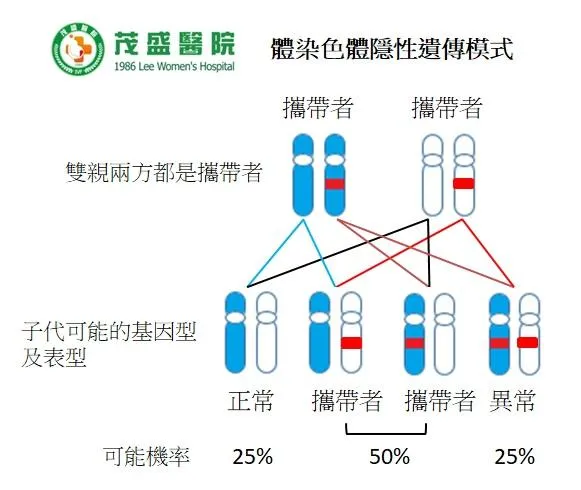 若夫妻雙方皆為同一疾病帶因者,子女有25%機率罹病、50%機率為帶因者、25%既不罹病也不帶有致病變異基因。(圖/茂盛醫院)