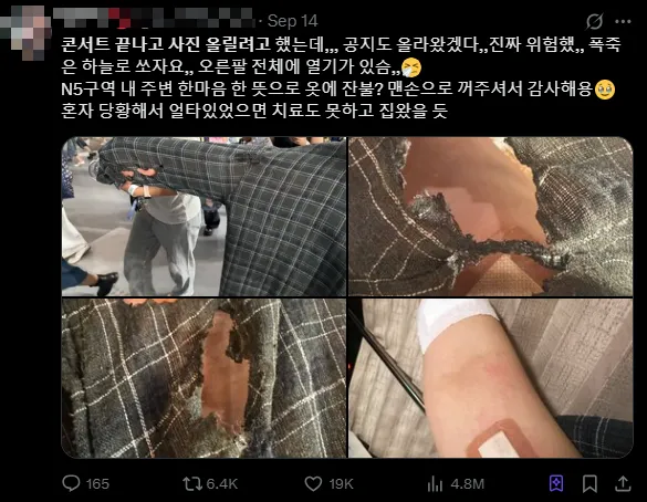 粉絲PO出被燙傷的照片。（圖／翻攝自X）