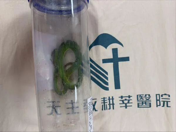 老翁遭青竹絲咬後將蛇打死，就醫時將蛇本尊一併帶來。（圖／新店耕莘提供）