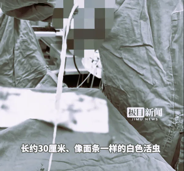 醫生從老婦乳房中取出30公分的活蟲。（圖經變色處理／翻攝《極目新聞》）