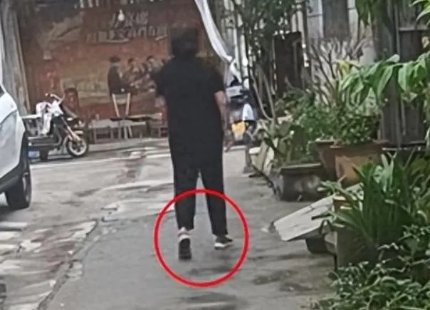任女手術後走路一拐一拐。（圖/翻攝《網易》）