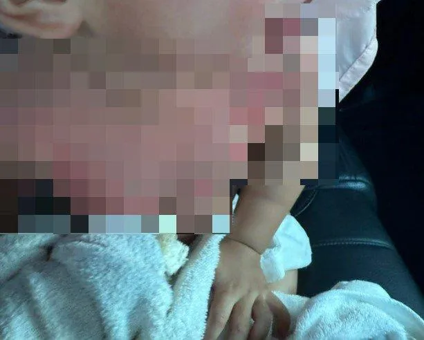 1歲半男童嚴重燒燙傷緊急送醫。（圖／李小姐授權提供）