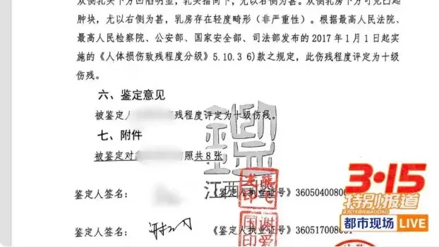玲玲因胸部畸形被評定為十級傷殘。（圖／翻攝《都市現場》）