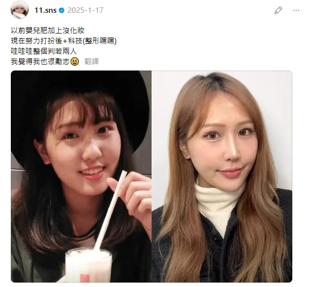 蕭伊曾分享整形前後對比照。（圖／翻攝自蕭伊Threads）