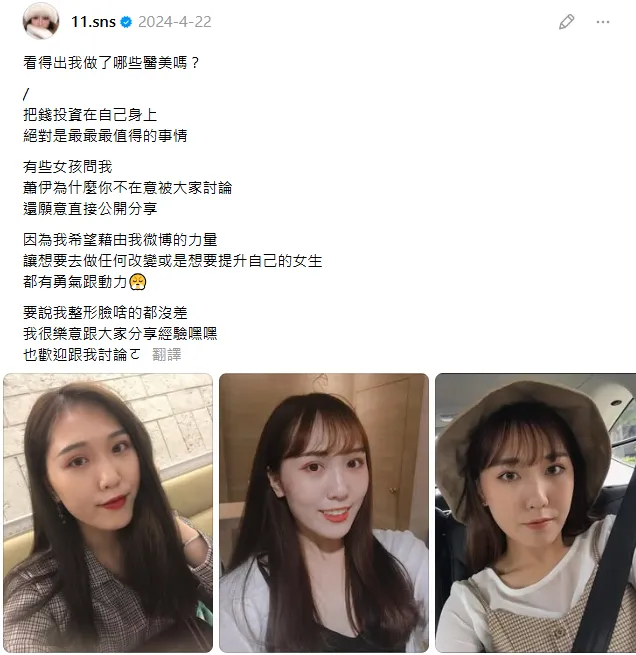 蕭伊曾分享隆鼻前的照片。（圖／翻攝自蕭伊Threads）