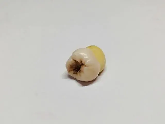 老婦因為滿口蛀牙,導致細菌感染,最終細菌入侵腦部,形成腦膿瘍。(圖/Photo AC)