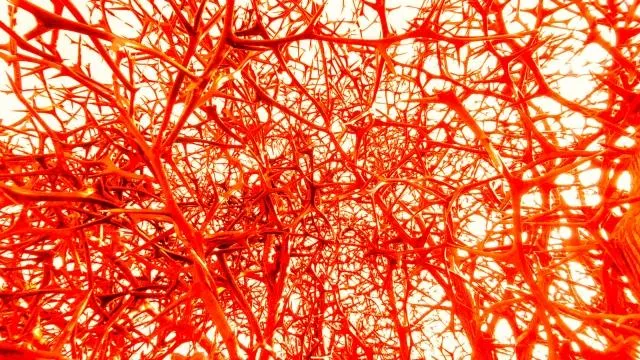 頸動脈狹窄是導致缺血性中風的重要原因之一，早期症狀常不明顯。（圖／Photo AC）