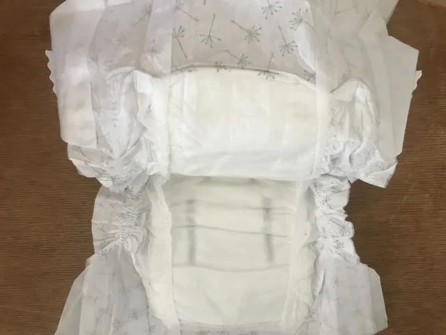 一名女性在婦科手術後罹患罕見併發症「膀胱陰道廔管」，導致尿液從陰道口不斷滲漏，她被醫師宣告需終身包尿布。（圖／Photo AC）