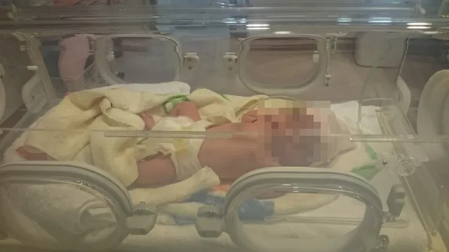 女嬰出生第3天開始發燒、呼吸困難，並有呼吸暫停、心跳變慢等警訊，最後不幸身亡。（示意圖／Photo AC）