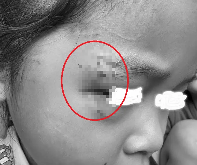 黑狗突然攻擊導致2名女童頭部、身體受傷。。（圖／中天新聞）