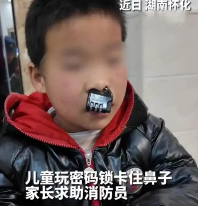 男童玩耍時將密碼鎖環往鼻樑上套無法卸除。（圖／翻攝網路）