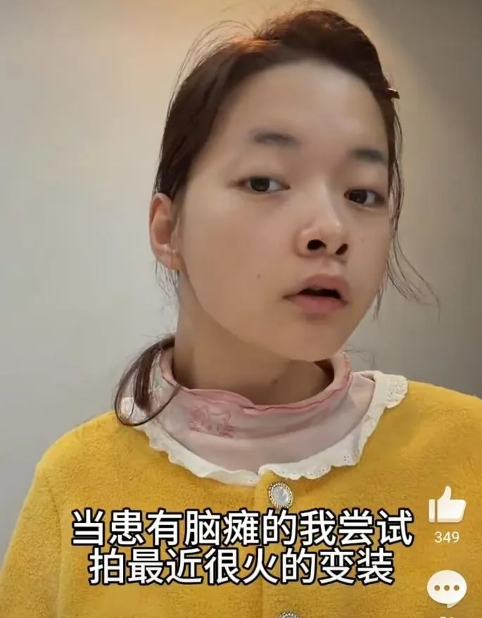 「小糍粑」患有腦癱，有網友質疑裝病。（圖／翻攝抖音「林小糍粑」）
