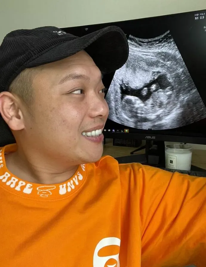 阿虎在節目中罕見提起失去愛女的心路歷程。(圖/翻攝 阿虎-吳致任 臉書)