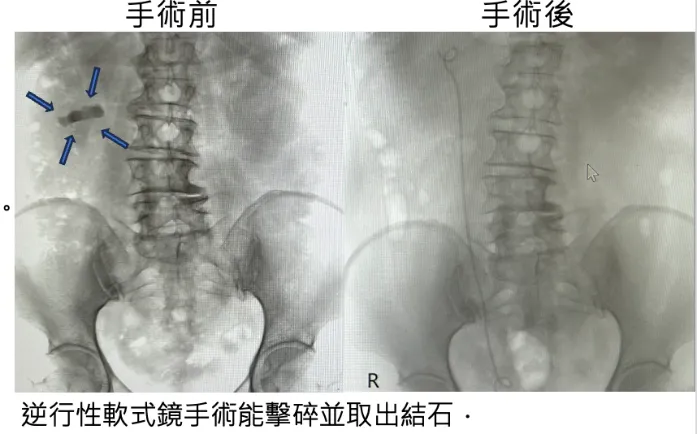 實際使用案例分享。（圖／林嘉緯醫師提供）
