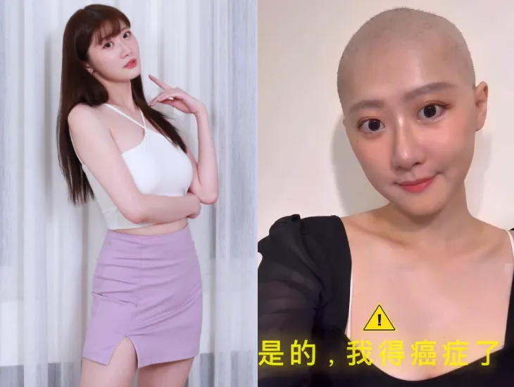 林茉晶先前被診斷出罹患卵巢癌,隨即展開為期半年、共6次的化療。(圖/翻攝自林茉晶IG)