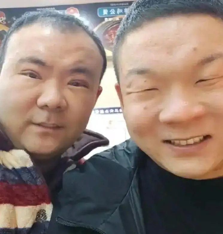 崔磊先弟弟一步，接受了割雙眼皮手術。（圖／翻攝《大象新聞》）
