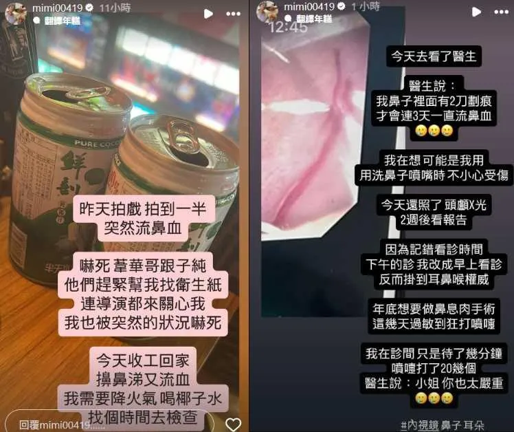 米可白曝檢查結果。（圖／翻攝IG mimi00419）