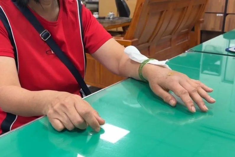 婦人手腕腫起，佩戴在手腕上的玉鐲逐漸陷入皮肉之中。（圖／中天新聞）