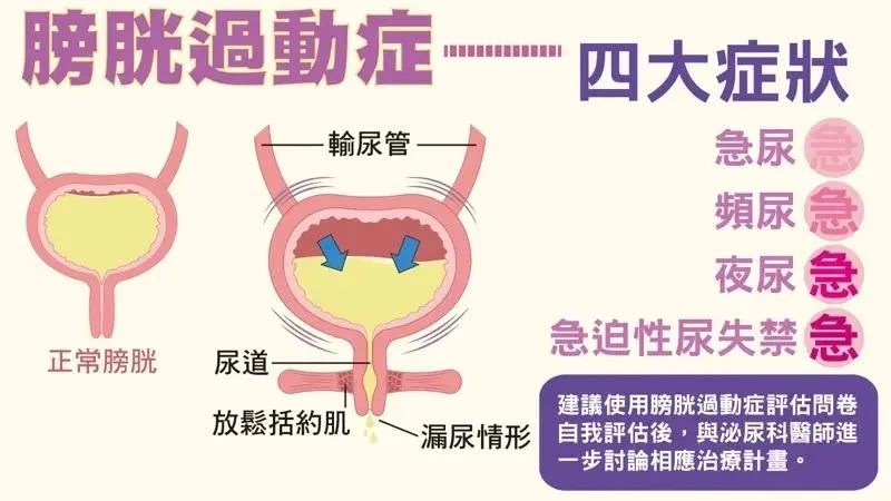 膀胱過動症患者會因為難以控制的頻尿、夜尿與尿急感,對日常生活造成多方面的影響。(圖/振興醫院)