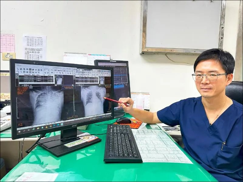 男子被送醫急救時狀況相當危急,影像檢查顯示雙側肺部出現大片浸潤影像,顯示已處於嚴重缺氧狀態。(圖/豐原醫院)