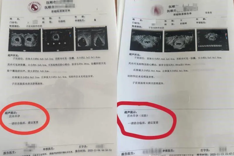 遼寧一名30歲王姓孕婦11月起產檢,第一次為單胎、第二次檢查變成雙胎,最終檢查出懷了四胞胎。(圖/翻攝極目新聞)